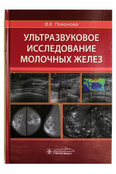 Вероника Гажонова: Ультразвуковое исследование молочных желез. Руководство